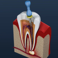 Endodontics