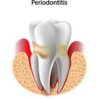 Periodontics
