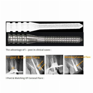Prime Dental i Post Endodontic Metal Post Refills