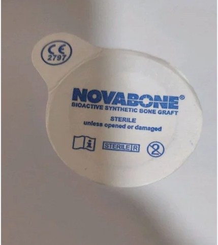 PerioGlas 0.5 cc - Bioactive Synthetic Bone (1 vial x 0.5cc)