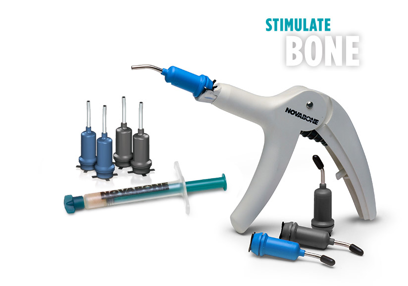 Novabone Putty Mini Cartridge - Single Cartridge of 0.25 cc (Alloplastic graft in PUTTY consistency)