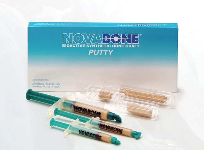 Novabone Putty Double Syringe - 2 syringes x 0.5 cc (Alloplastic graft in PUTTY consistency)