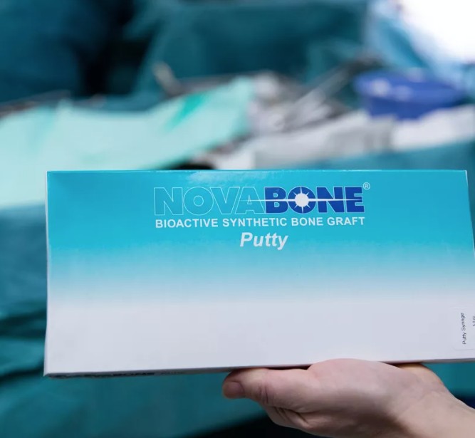 Novabone Putty Syringe - Single syringe x 0.5 cc (Alloplastic graft in PUTTY consistency)
