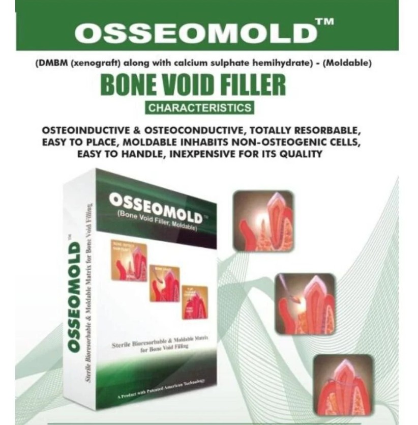 Osseomold (demineralized bone-derived Type-I collagen) 2 x 0.5 cc vials