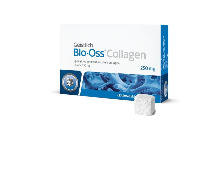 Bio-Oss Collagen 250 MG (Spongious Bone Substitute)