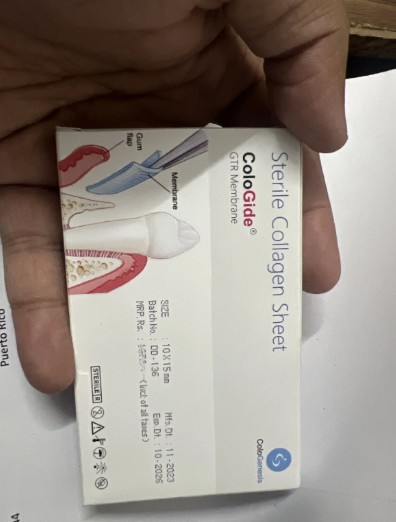 Colo Gide 10 x 15 mm (Resorbable GTR Membrane) Single Unit pack