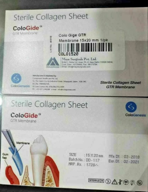 Colo Gide 15 x 20 mm (Resorbable GTR Membrane) Single Unit pack