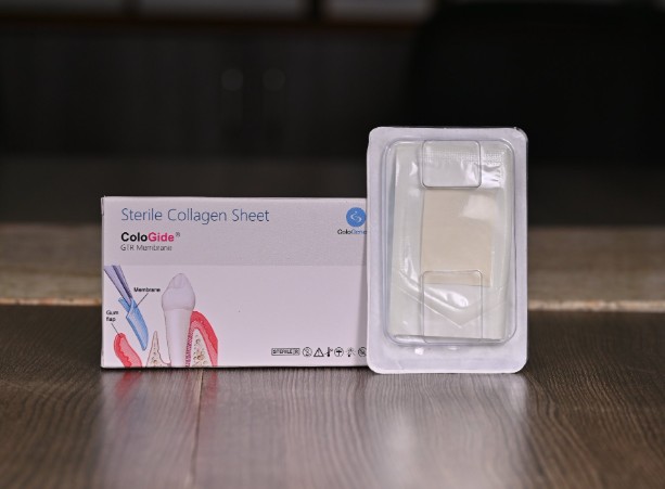 Colo Gide 30 x 40 mm (Resorbable GTR Membrane) Single Unit pack