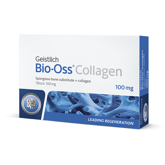 Bio-Oss Collagen 100 MG (Spongious Bone Substitute)