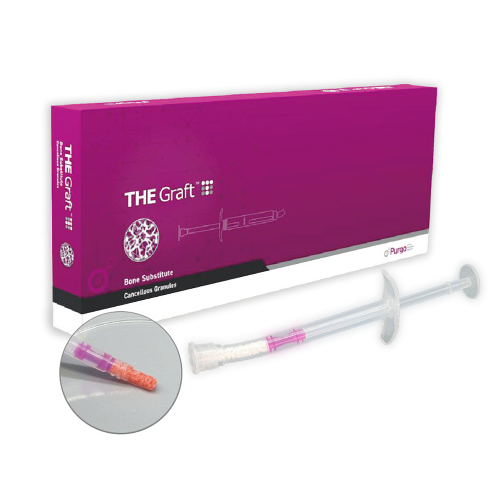 THE Graft Syringe Type  1 CC (0.25-1 mm Small particles) Natural Mineral bone matrix