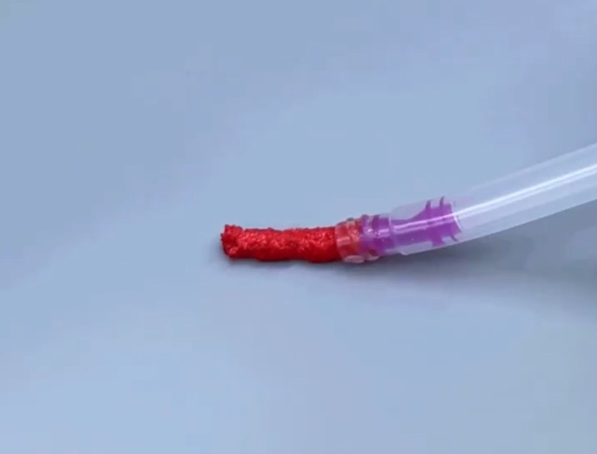 THE Graft Syringe Type  1 CC (0.25-1 mm Small particles) Natural Mineral bone matrix