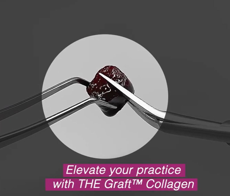 THE Graft Collagen Block 7x7x7 mm (0.34 cc) Collagenated Block Bone