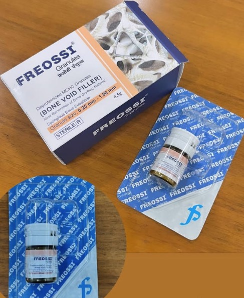 Freossi 0.5 gram = 1.0 cc (0.25 - 1 mm Small particles)  Bone Graft Granules