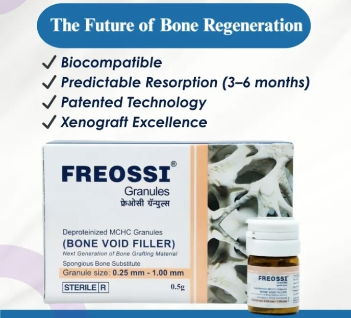 Freossi 0.5 gram = 1.0 cc (0.25 - 1 mm Small particles)  Bone Graft Granules