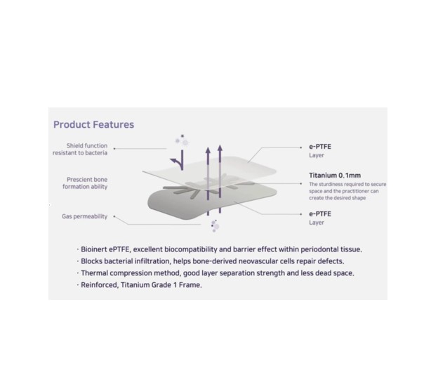 Innotex Plain PTFE Membrane 15x25 mm Non-Resorbable (South Korea)