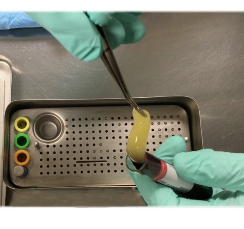 GDC Platelet Rich Fibrin Box (PRF)