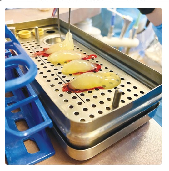 GDC Platelet Rich Fibrin Box (PRF)