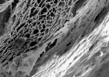 Fix Gide GTR Membrane (Sterile resorbable Collagen membrane) - All variants