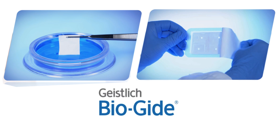 Bio-Gide (Resorbable Bi-layered collagen membrane) - All variants